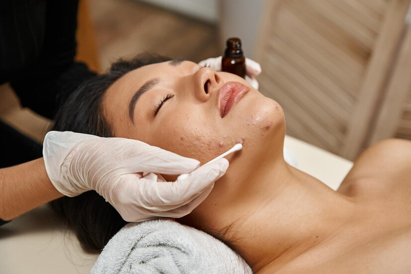 Blemishes treatment