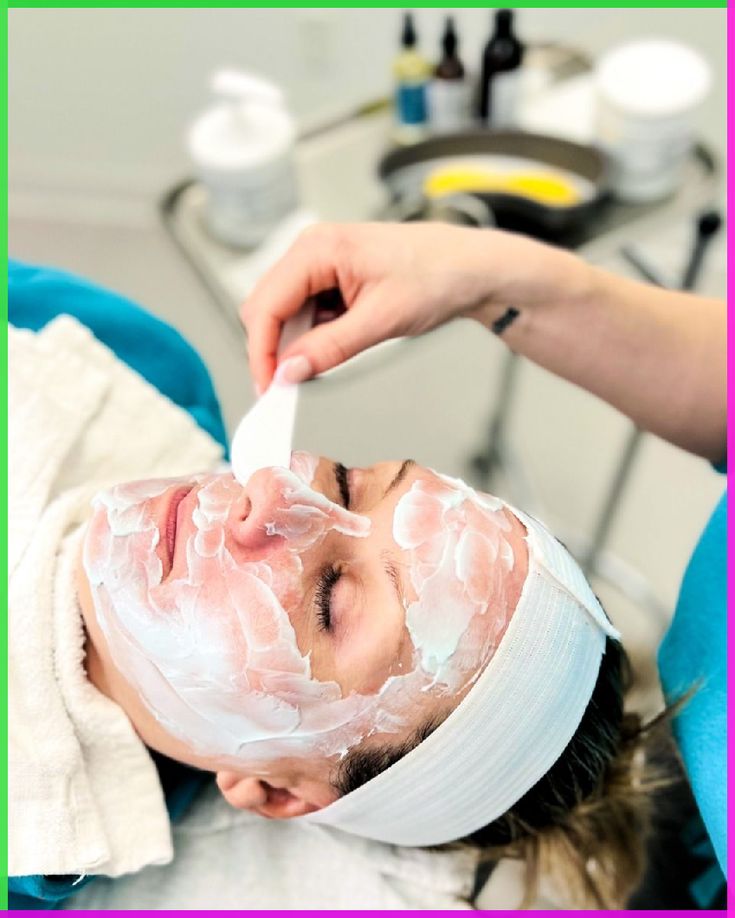 Chemical peel