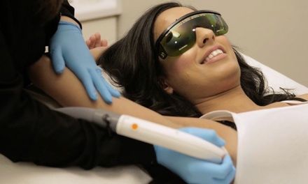 Laser hair reduction